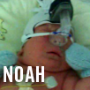 NOAH HACKETT