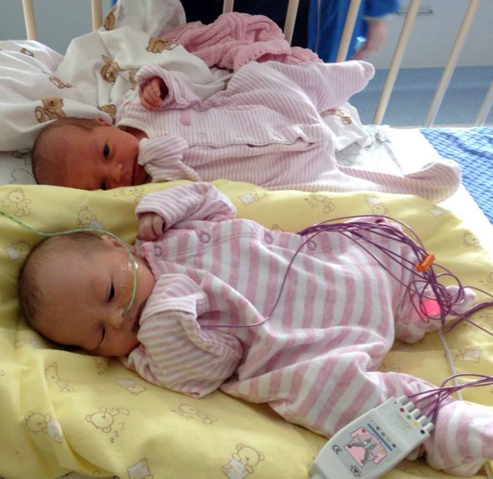 When Linda Farrelly was pregnant with twins girls, it was discovered that one of the girls had a very serious heart condition