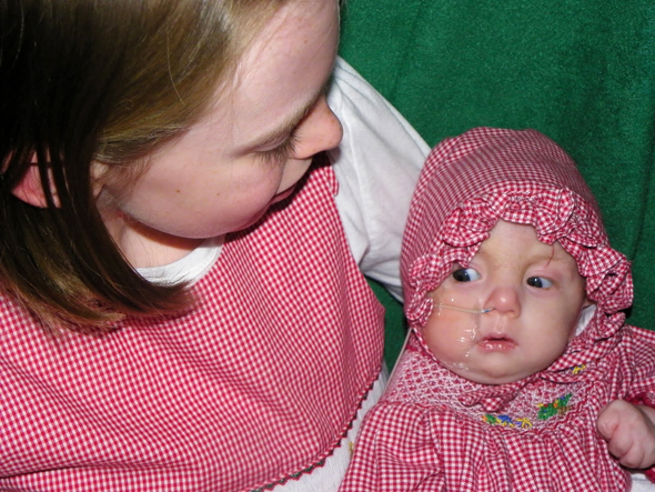 Lily with her sister just before Christmas