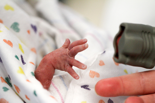 Miranda Stewarts baby son Wyatt was diagnosed an anencephaly at her 12-week scan